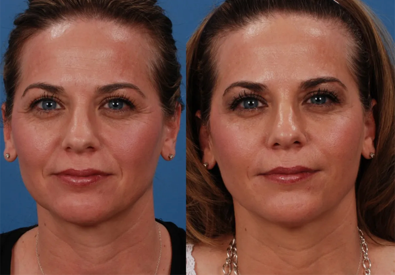 rejuvenation-image