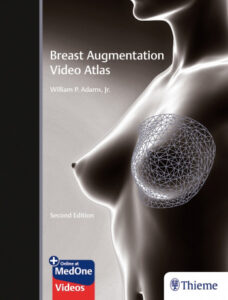 breast augmentation atlas